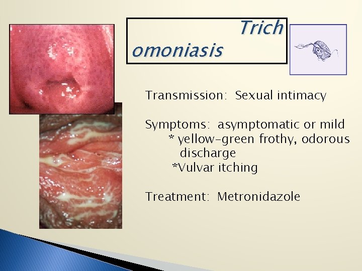 omoniasis Trich Transmission: Sexual intimacy Symptoms: asymptomatic or mild * yellow-green frothy, odorous discharge