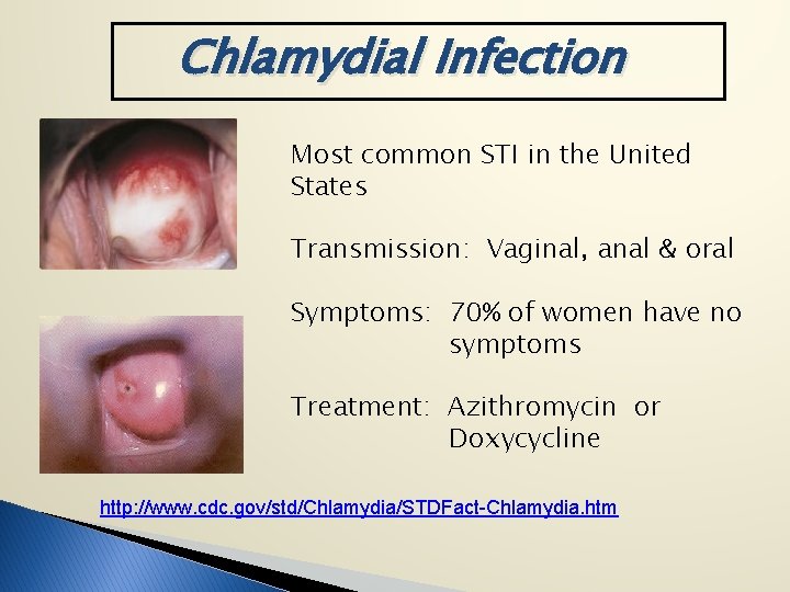 Chlamydial Infection Most common STI in the United States Transmission: Vaginal, anal & oral