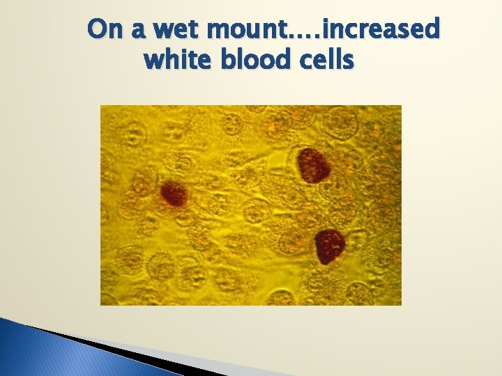 On a wet mount…. increased white blood cells 