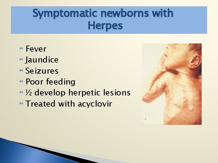 Symptomatic newborns with Herpes Fever Jaundice Seizures Poor feeding ½ develop herpetic lesions Treated