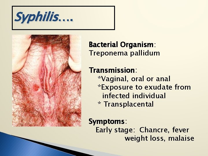 Syphilis…. Bacterial Organism: Treponema pallidum Transmission: *Vaginal, oral or anal *Exposure to exudate from