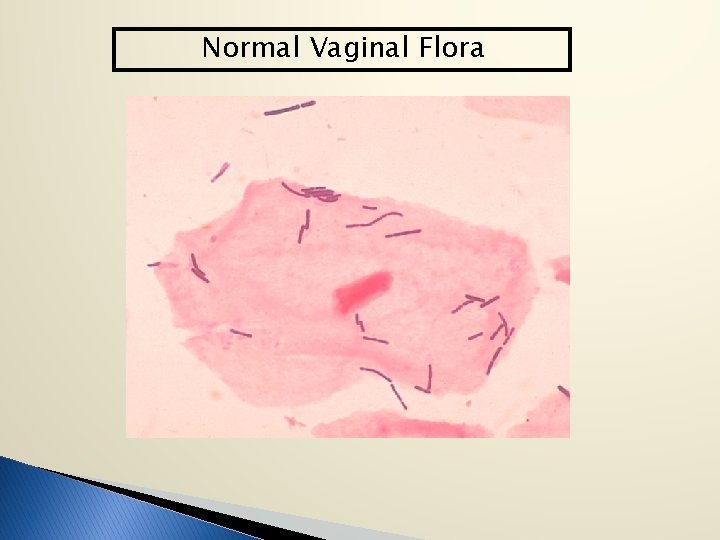 Normal Vaginal Flora 