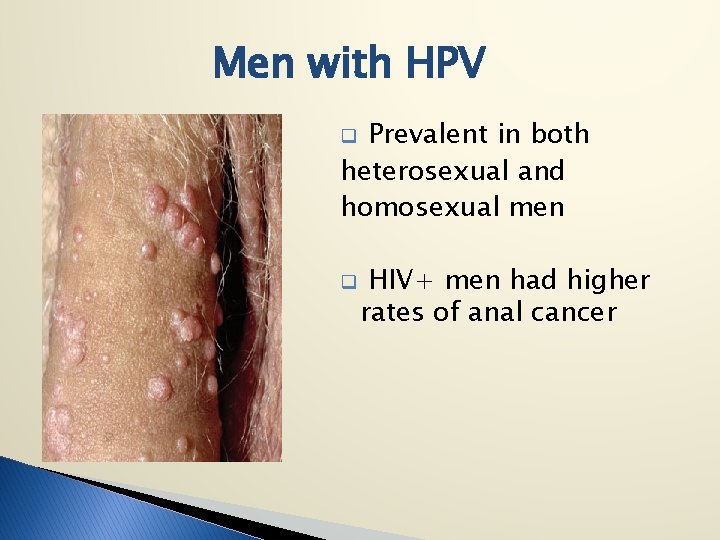 Men with HPV Prevalent in both heterosexual and homosexual men q q HIV+ men