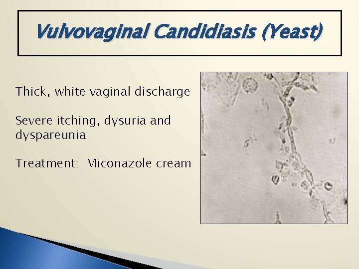 Vulvovaginal Candidiasis (Yeast) Thick, white vaginal discharge Severe itching, dysuria and dyspareunia Treatment: Miconazole