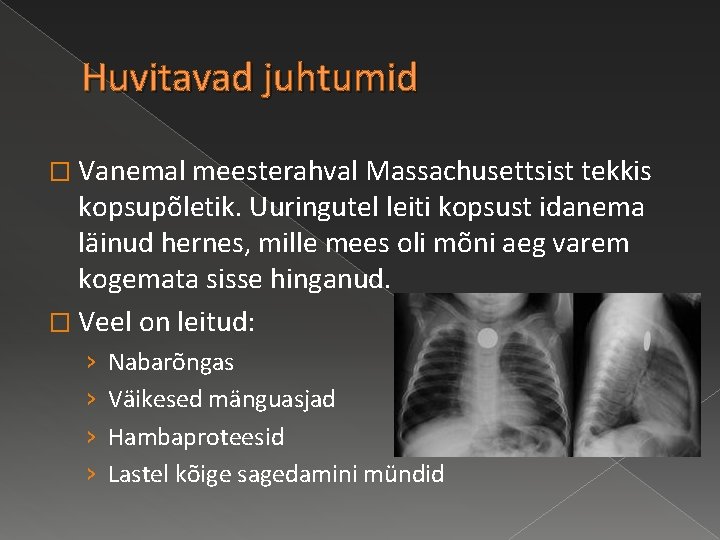 Huvitavad juhtumid � Vanemal meesterahval Massachusettsist tekkis kopsupõletik. Uuringutel leiti kopsust idanema läinud hernes,