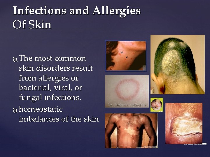 Infections and Allergies Of Skin The most common