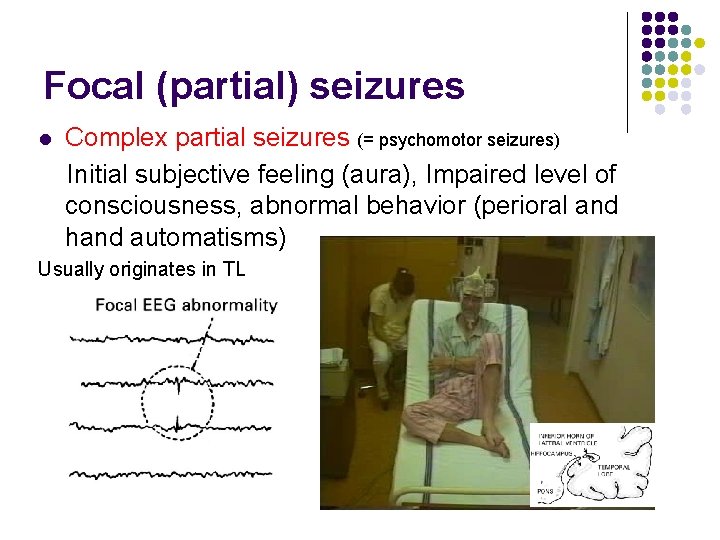 Focal (partial) seizures l Complex partial seizures (= psychomotor seizures) Initial subjective feeling (aura),