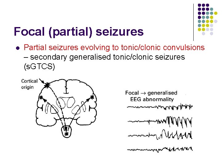 Focal (partial) seizures l Partial seizures evolving to tonic/clonic convulsions – secondary generalised tonic/clonic
