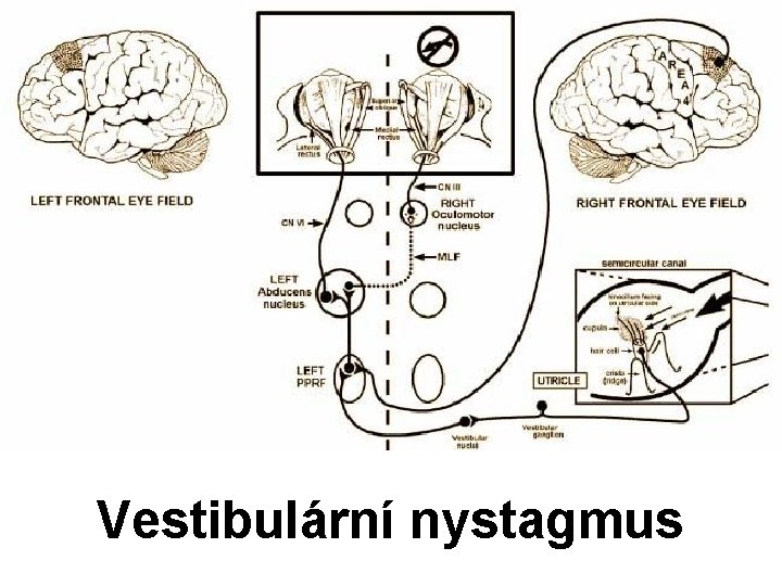 Vestibulární nystagmus 