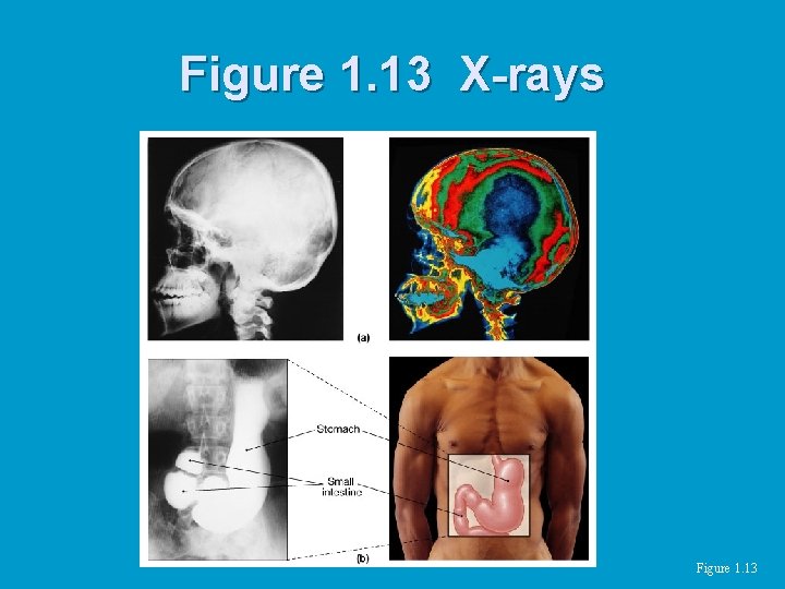 Figure 1. 13 X-rays Figure 1. 13 