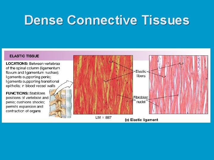 Dense Connective Tissues 