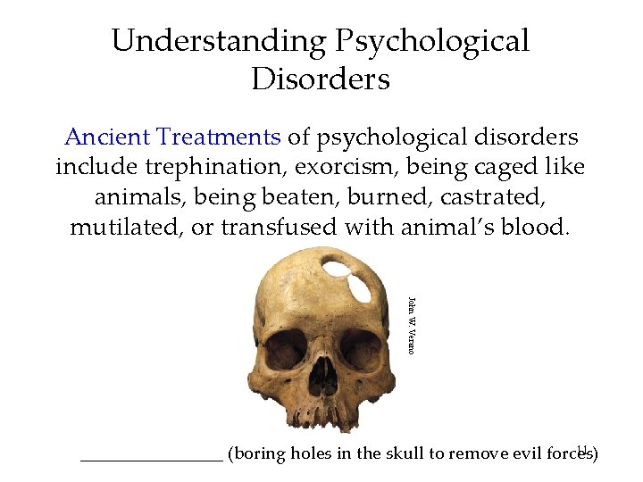 Understanding Psychological Disorders Ancient Treatments of psychological disorders include trephination, exorcism, being caged like