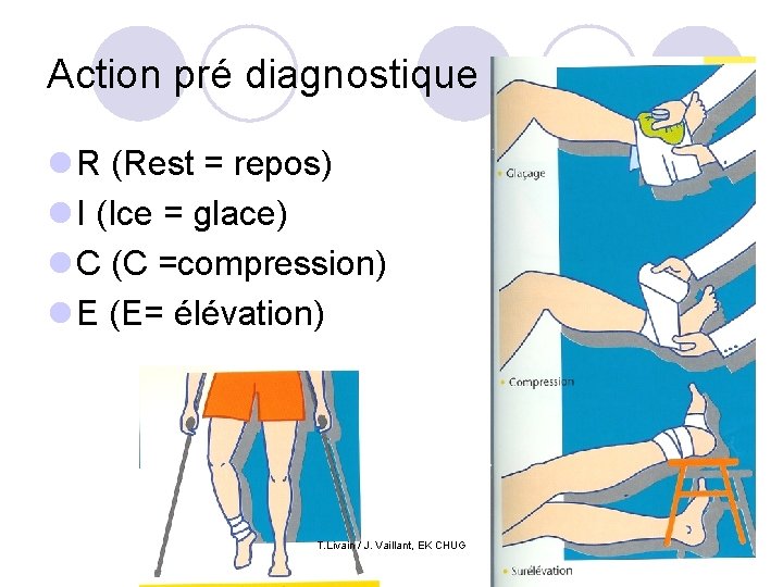 Action pré diagnostique : l R (Rest = repos) l I (Ice = glace)