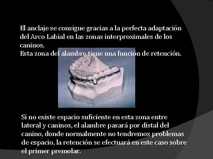 El anclaje se consigue gracias a la perfecta adaptación del Arco Labial en las