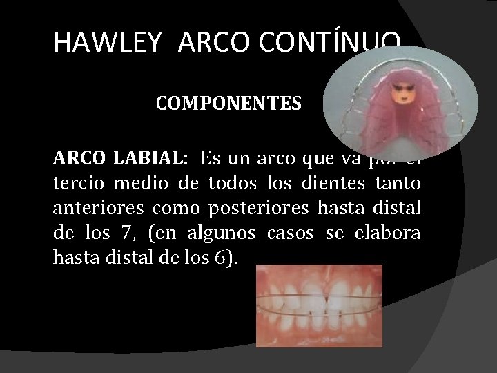 HAWLEY ARCO CONTÍNUO COMPONENTES ARCO LABIAL: Es un arco que va por el tercio