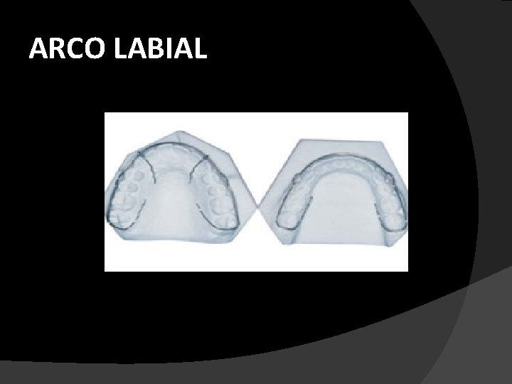 ARCO LABIAL 