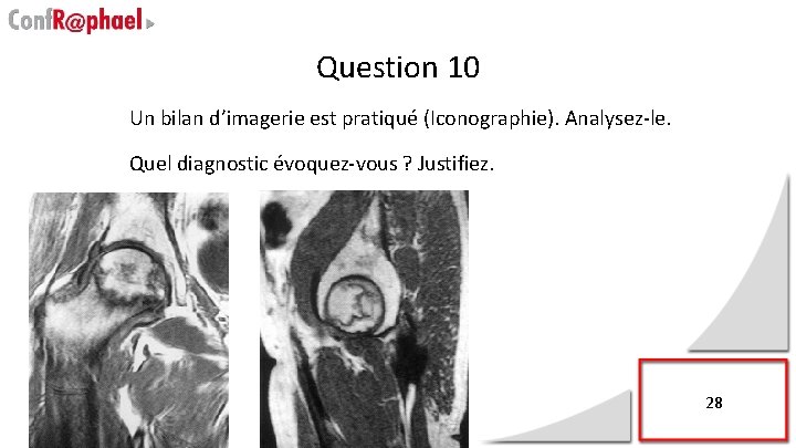 Question 10 Un bilan d’imagerie est pratiqué (Iconographie). Analysez-le. Quel diagnostic évoquez-vous ? Justifiez.