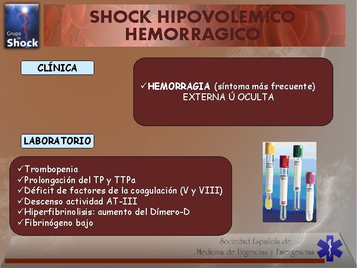 SHOCK HIPOVOLEMICO HEMORRAGICO CLÍNICA üHEMORRAGIA (síntoma más frecuente) EXTERNA Ú OCULTA LABORATORIO üTrombopenia üProlongación