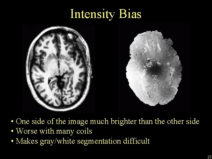 Intensity Bias • One side of the image much brighter than the other side