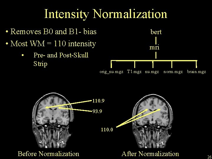 Intensity Normalization • Removes B 0 and B 1 - bias • Most WM
