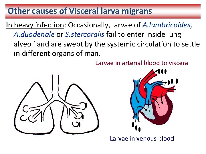 Other causes of Visceral larva migrans In heavy infection: Occasionally, larvae of A. lumbricoides,