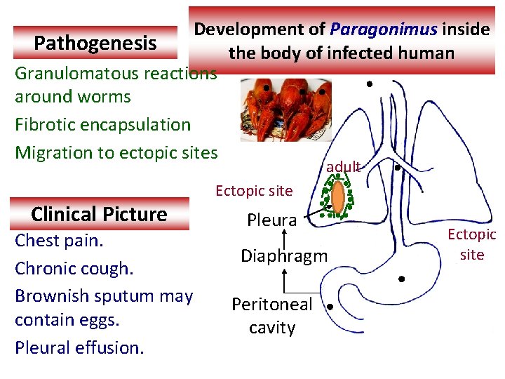 Development of Paragonimus inside Pathogenesis the body of infected human Granulomatous reactions around worms