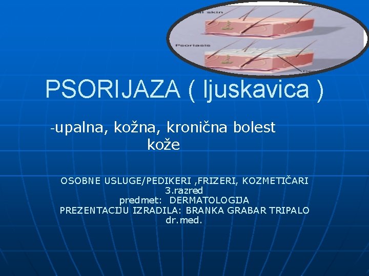 PSORIJAZA ( ljuskavica ) -upalna, kožna, kronična bolest kože OSOBNE USLUGE/PEDIKERI , FRIZERI, KOZMETIČARI