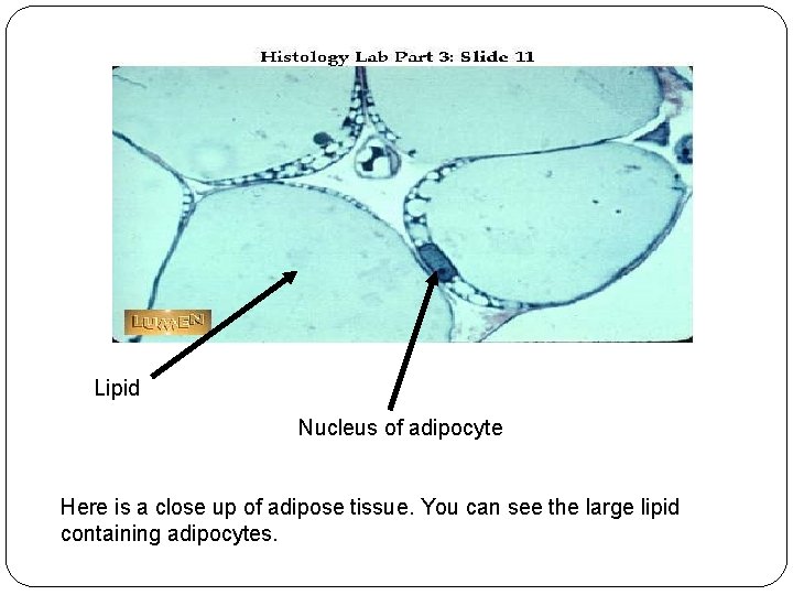 Lipid Nucleus of adipocyte Here is a close up of adipose tissue. You can