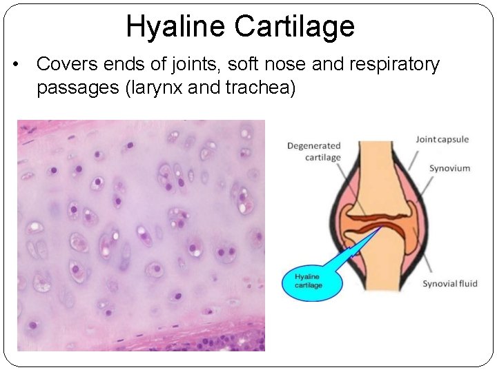 Hyaline Cartilage • Covers ends of joints, soft nose and respiratory passages (larynx and