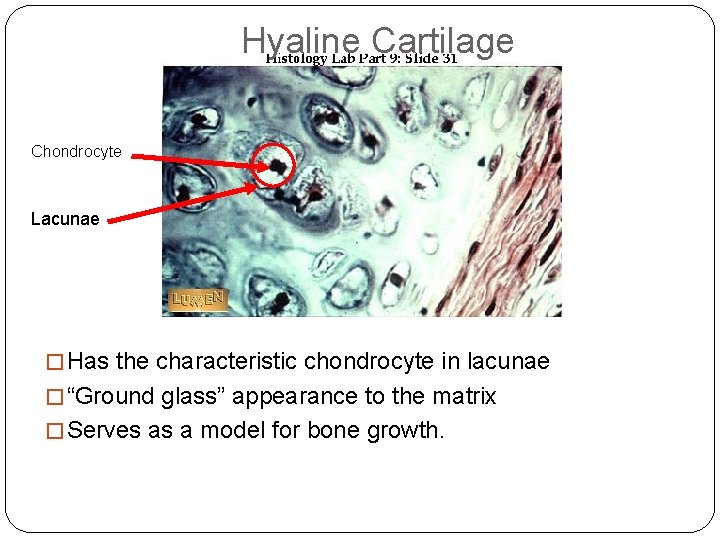 Hyaline Cartilage Chondrocyte Lacunae � Has the characteristic chondrocyte in lacunae � “Ground glass”