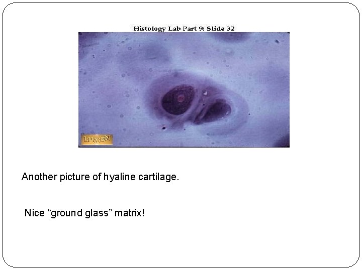 Another picture of hyaline cartilage. Nice “ground glass” matrix! 