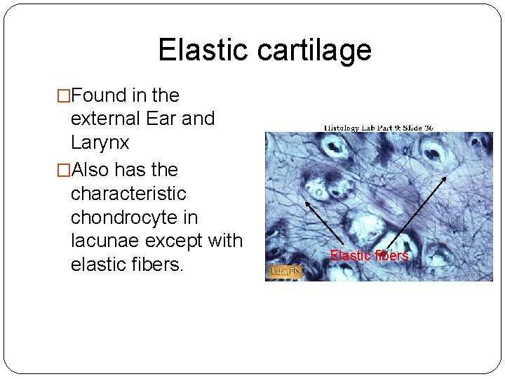 Elastic cartilage �Found in the external Ear and Larynx �Also has the characteristic chondrocyte