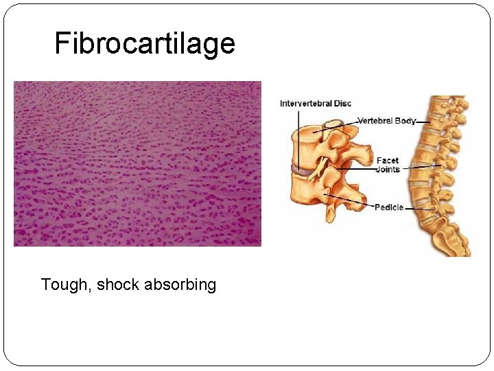 Fibrocartilage Tough, shock absorbing 