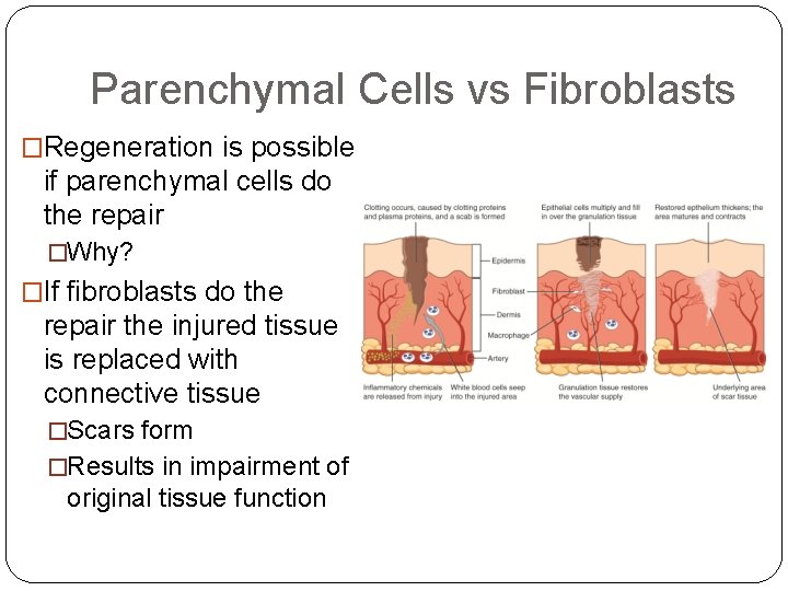 Parenchymal Cells vs Fibroblasts �Regeneration is possible if parenchymal cells do the repair �Why?