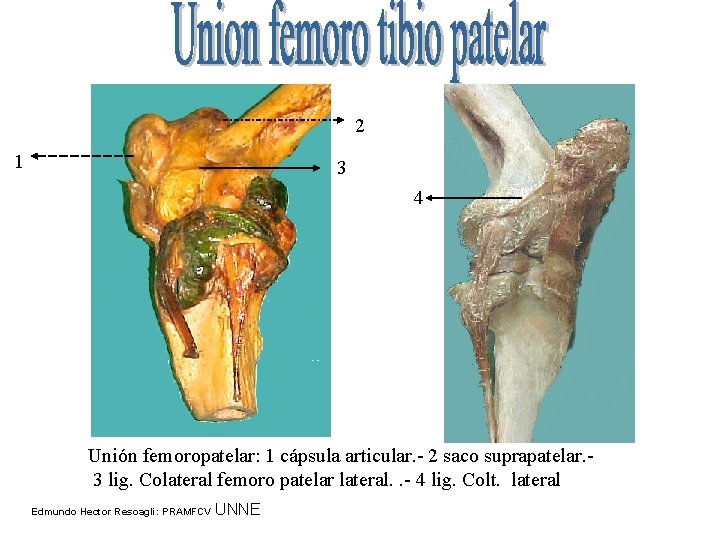 2 1 3 4 Unión femoropatelar: 1 cápsula articular. - 2 saco suprapatelar. 3