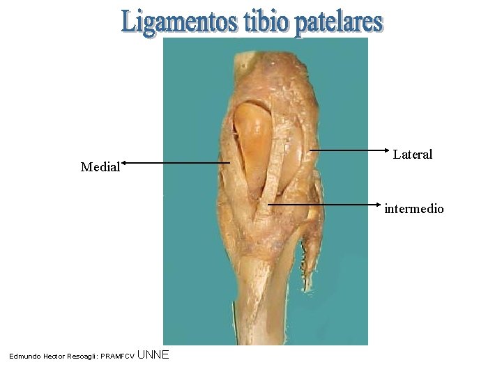 Lateral Medial intermedio Edmundo Hector Resoagli: PRAMFCV UNNE 