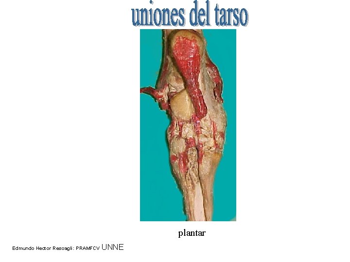 plantar Edmundo Hector Resoagli: PRAMFCV UNNE 