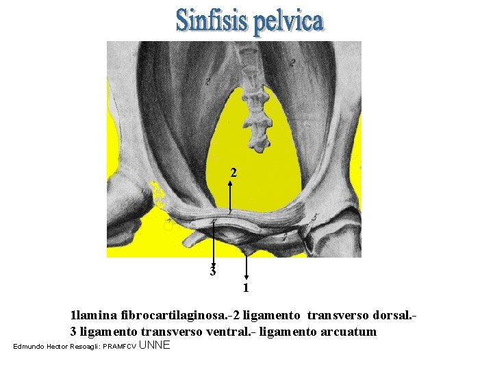 2 3 1 1 lamina fibrocartilaginosa. -2 ligamento transverso dorsal. 3 ligamento transverso ventral.