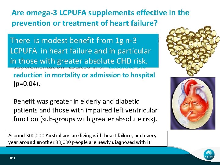 Are omega-3 LCPUFA supplements effective in the prevention or treatment of heart failure? GISSI-HF