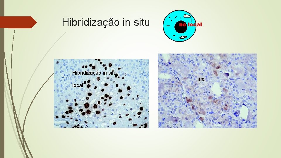 Hibridização in situ no local 