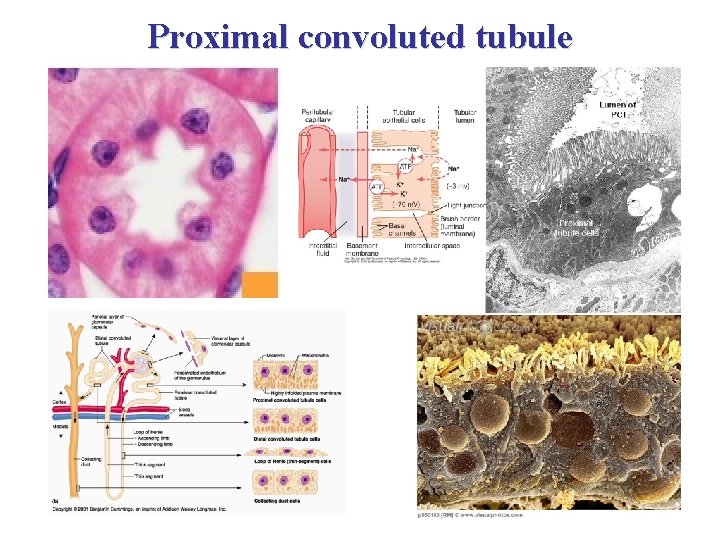 Proximal convoluted tubule 