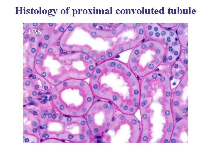 Histology of proximal convoluted tubule PAS 