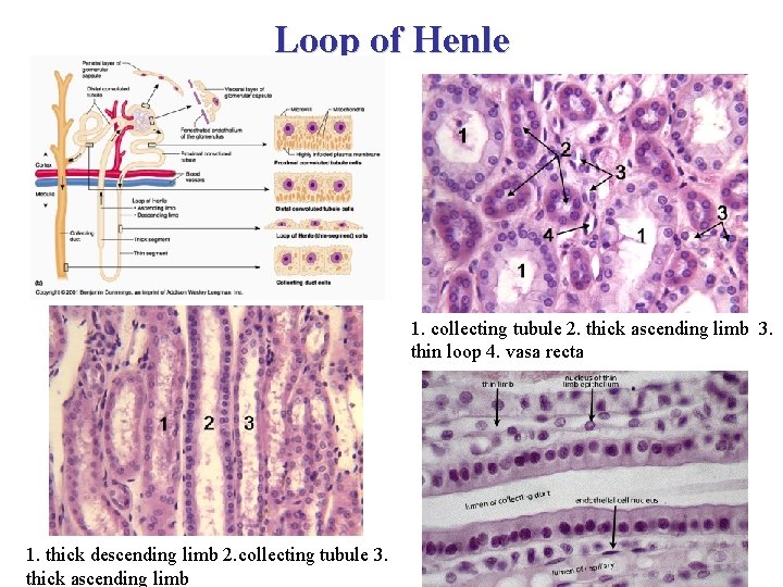 Loop of Henle 1. collecting tubule 2. thick ascending limb 3. thin loop 4.