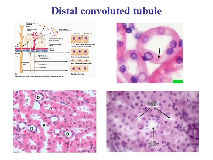 Distal convoluted tubule 