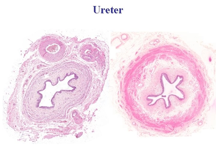 Ureter 