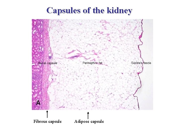 Capsules of the kidney Fibrous capsule Adipose capsule 