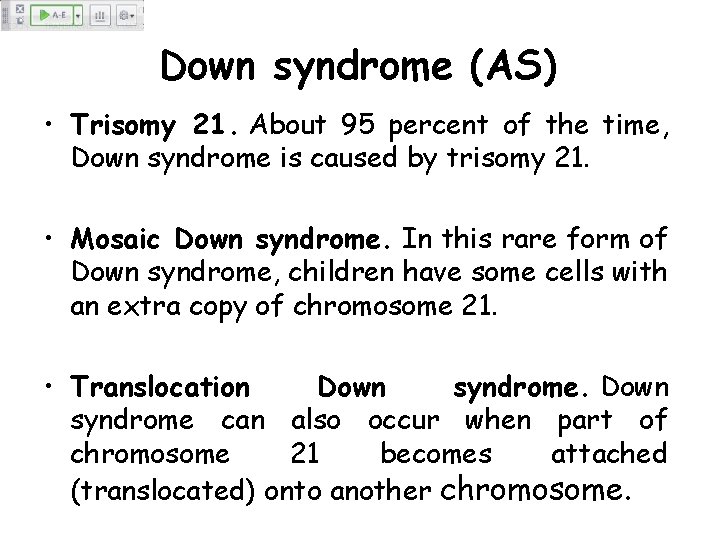 Down syndrome (AS) • Trisomy 21. About 95 percent of the time, Down syndrome