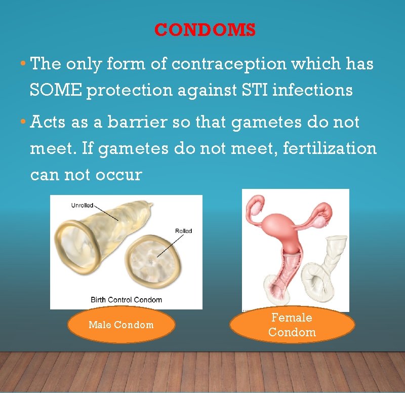 CONDOMS • The only form of contraception which has SOME protection against STI infections