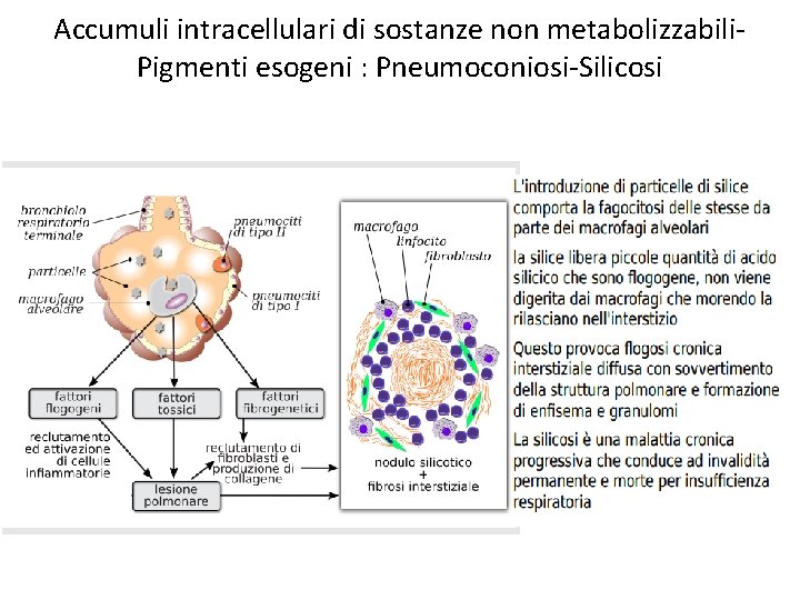 Accumuli intracellulari di sostanze non metabolizzabili. Pigmenti esogeni : Pneumoconiosi-Silicosi 