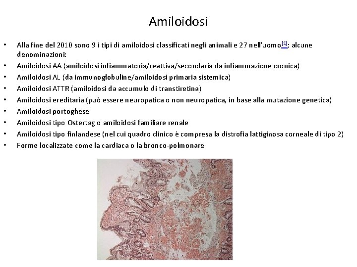 Amiloidosi • • • Alla fine del 2010 sono 9 i tipi di amiloidosi